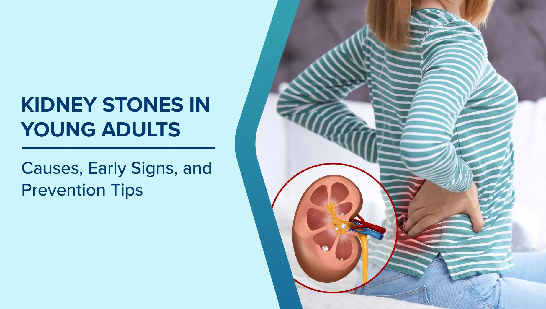 Blog post image for Kidney Stones in Young Adults: Causes, Early Signs, and Prevention Tips