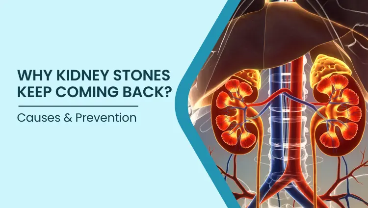 Blog post image for Why Kidney Stones Keep Coming Back | Causes & Prevention | Bangalore