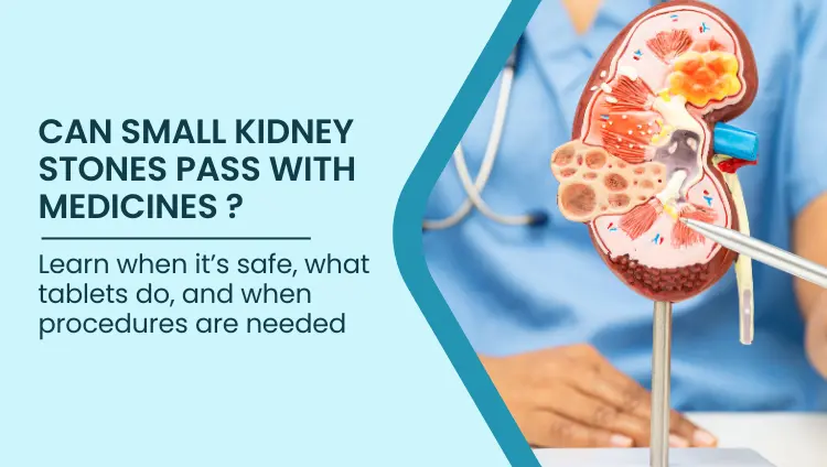 Blog post image for Can Small Kidney Stones Pass With Medicines Alone? | Bangalore