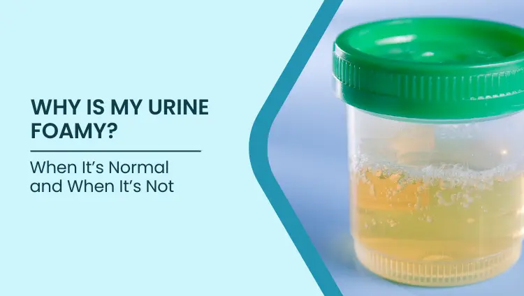Blog post image for Why Is My Urine Foamy? When It’s Normal and When It’s Not